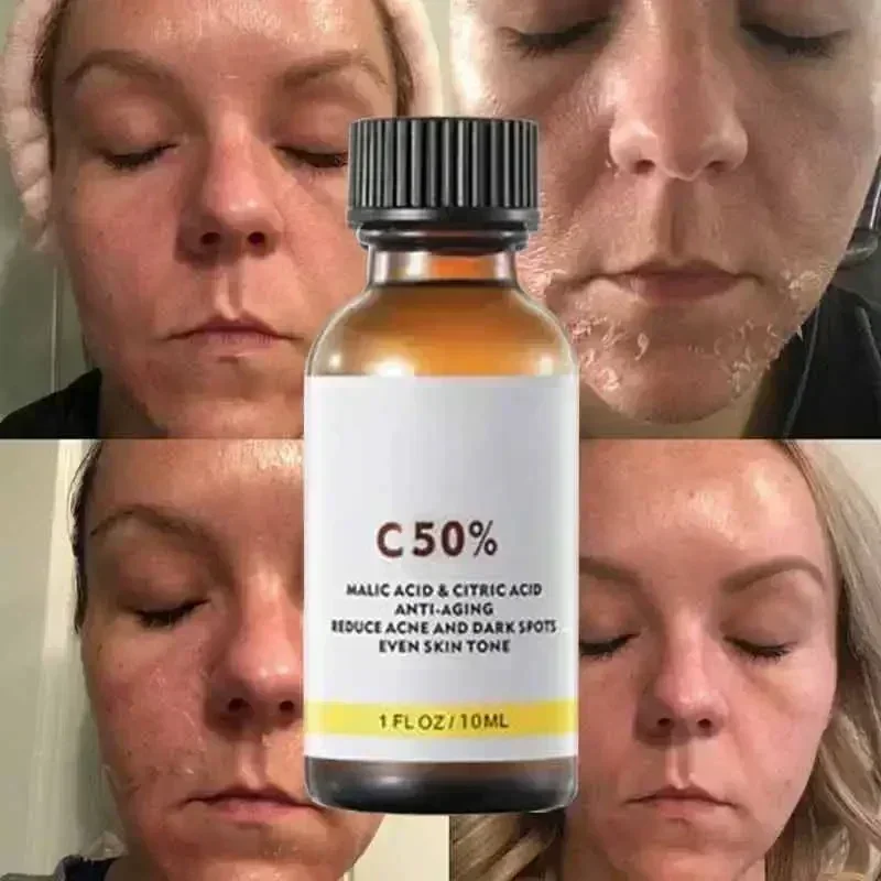 Cuidado facial exfoliante, piel radiante, manchas oscuras y pigmentación para una piel más brillante, elimina manchas, brazos, rodillas, piernas, melanina