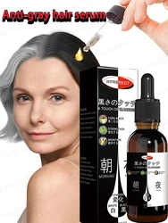 Let your gray hair return to its natural color, even if you are 80 years old, it will be effective and will not recur again