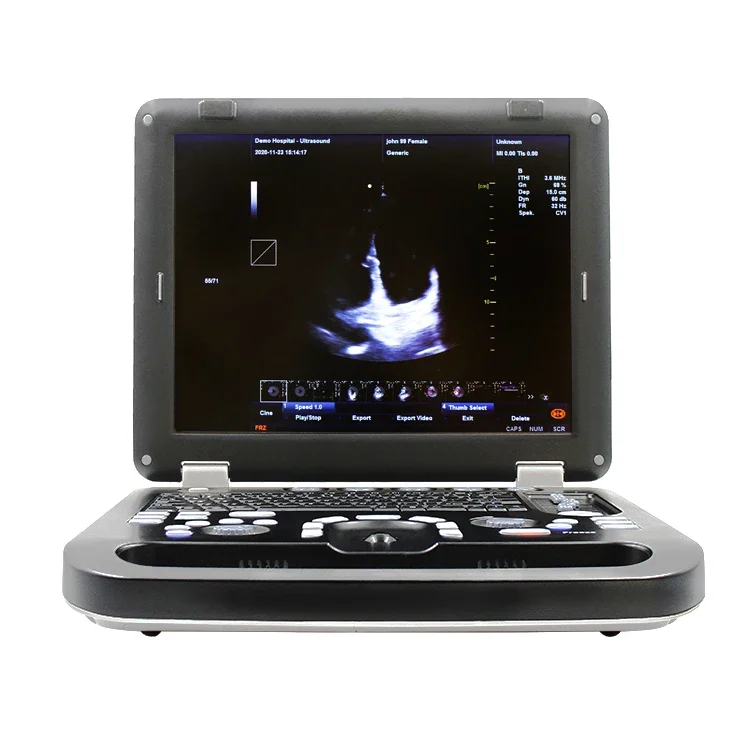 Professional Cardiology cheap portable medical ultrasound scanner