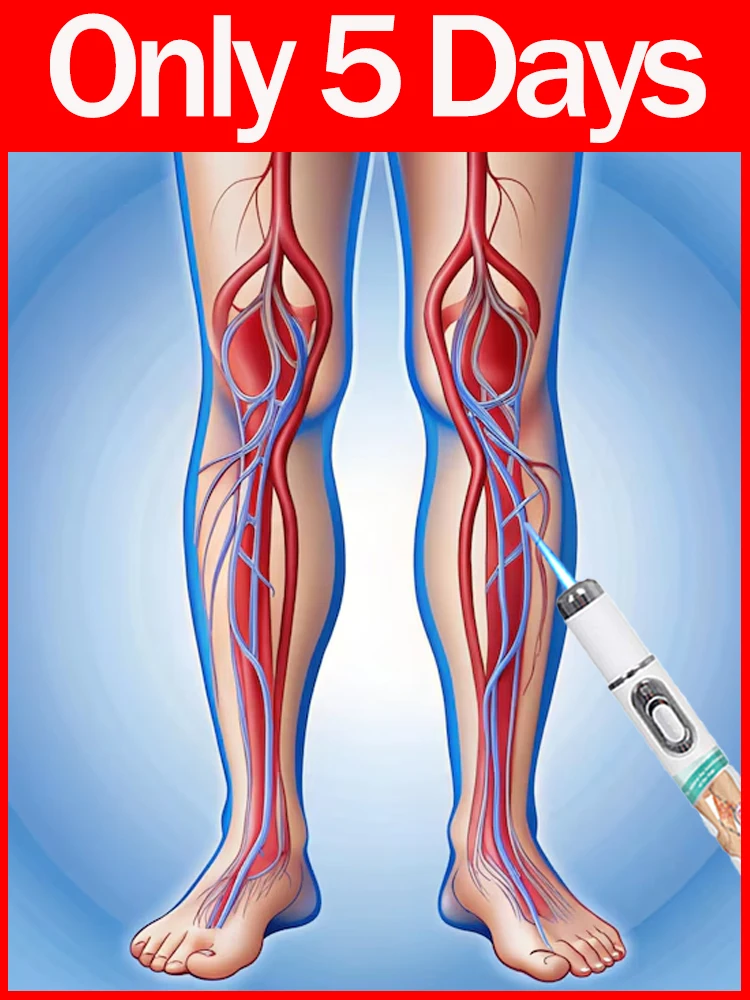 Feeling of ease after 7 days with the generation 3 blue light foot care tool