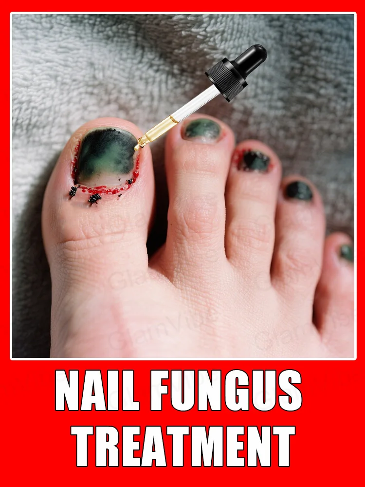 

2025 Toenail Fungus Patch Waterproof Nail Repair Patches Nail Ingrown Correction Sticker Discolored Damaged Nail Foot Care Tool
