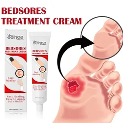 Decubitus Cream Pressure Sore Ulcer Skin Relief Ointment Bed Sore Wound Healing Treat Anti Dry Repair  Moisturizing Body Care