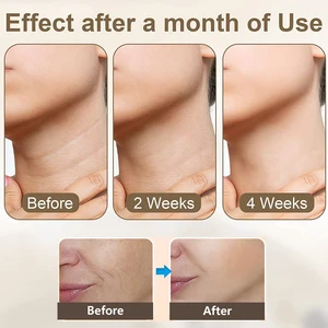 جهاز تدليك الوجه EMS لشد الوجه ، أداة تدليك الرقبة والعين ، هزاز التيار المتردد ، العلاج بالضوء الأحمر ، مضاد للتجاعيد أعلى 10 بيع مبيض الشرج - No3