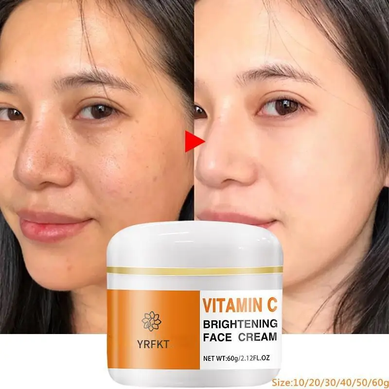 Crema iluminadora con vitamina C al 2022, crema blanqueadora Para manchas negras, desteñida repara la piel, pecas y melanina