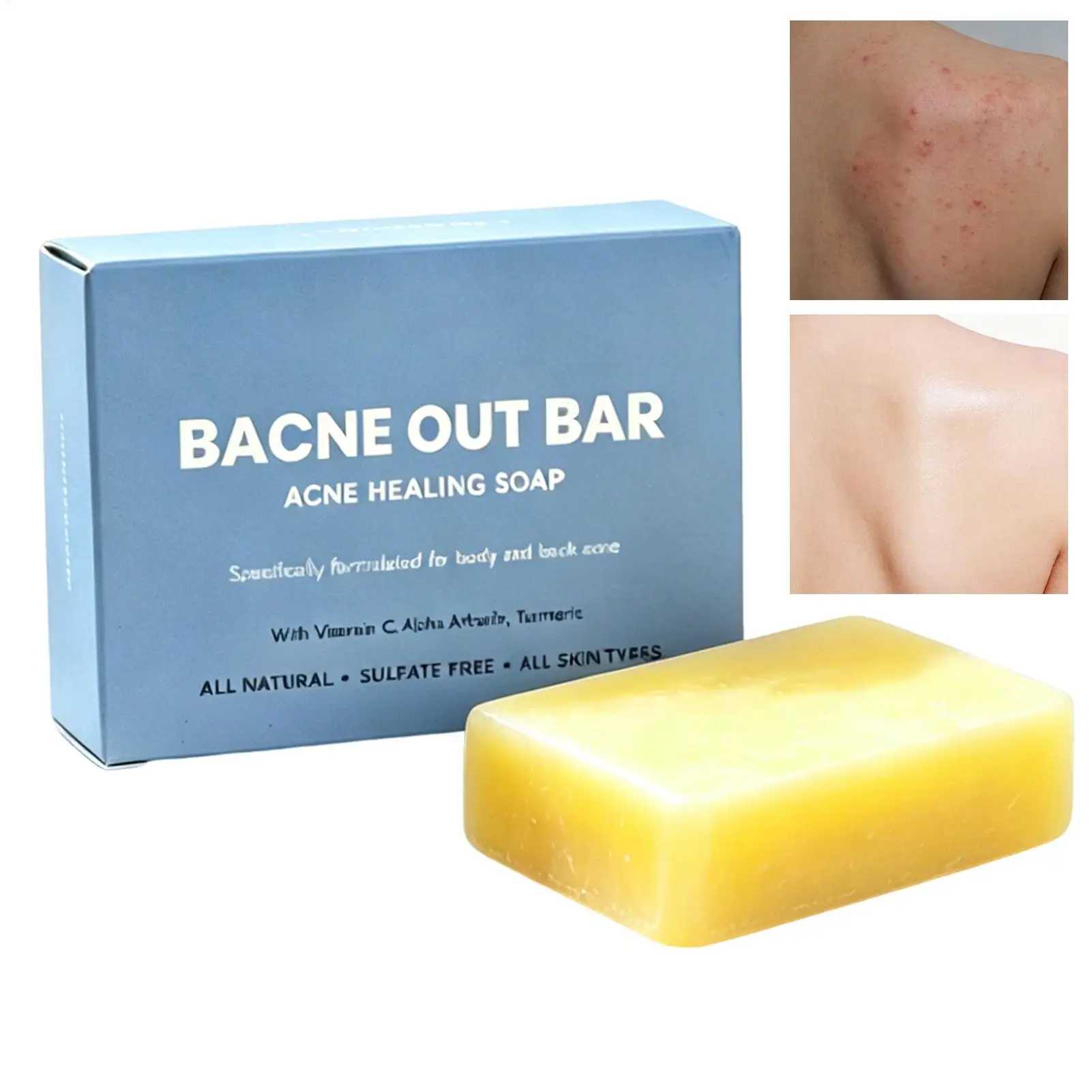 sabonete-liquido-multiuso-de-limpeza-100g-para-o-corpo-sabonete-removedor-de-acne-e-reparador-para-cuidados-diarios-com-a-pele