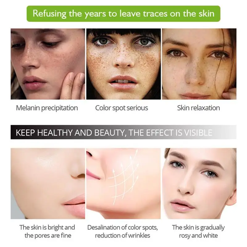 Skin Care Effective Whitening Freckle Cream Remove Melasma Acne Spot Pigment Melanin Dark Spots Pigmentation Moisturizing Gel