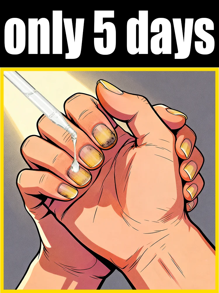 

Eʟɪᴍɪɴᴀᴛᴇ ғᴜɴɢᴀʟ ɴᴀɪʟs Rapid penetration, restoring nails to their natural shine. Say goodbye to fungal nails