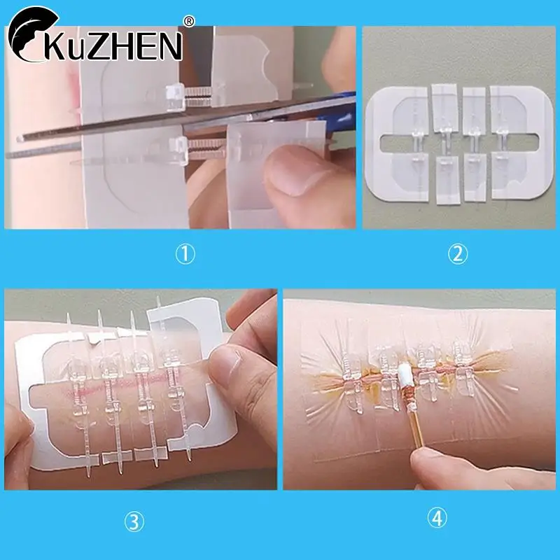 1/2/3/10Pcs Zipper Tie Wound Closure Patch Hemostatic Patch Wound Fast Suture Zipper Band-Aid Outdoor Portable Skin Care