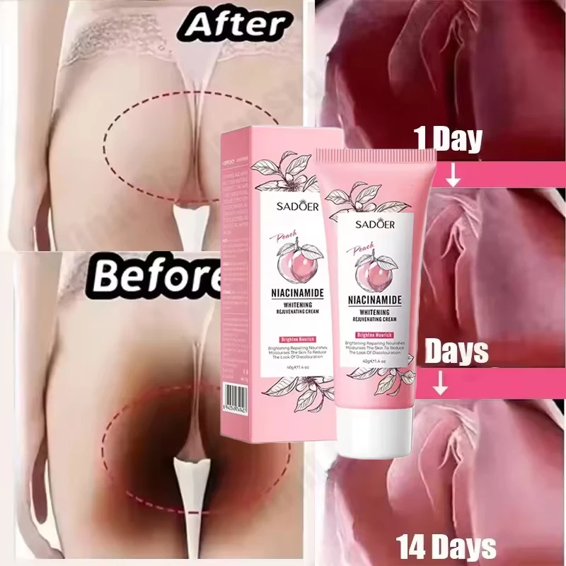 Crème blanchissante pour le corps peau foncée aisselles éclaircissante zones intimes aisselles blanchiment parties intimes crème blanchissante Lotion pour le corps beauté