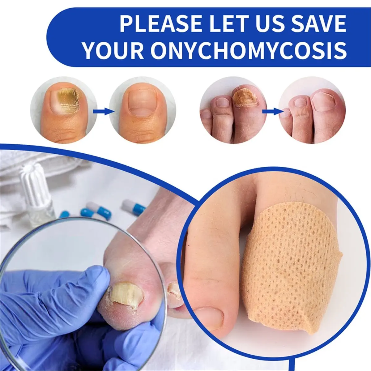618 Mega Sale 210pcs Nail Repair Patches Toenail Fungu Patch Nail Ingrown Correction Sticker Paronychia Disposable Toe Patch