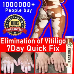 Vitiligo Repair Get Rid Of Ringworm White Spots Get Rid Of Skin Vitiligo Eliminate Vitiligo Better Body Skin