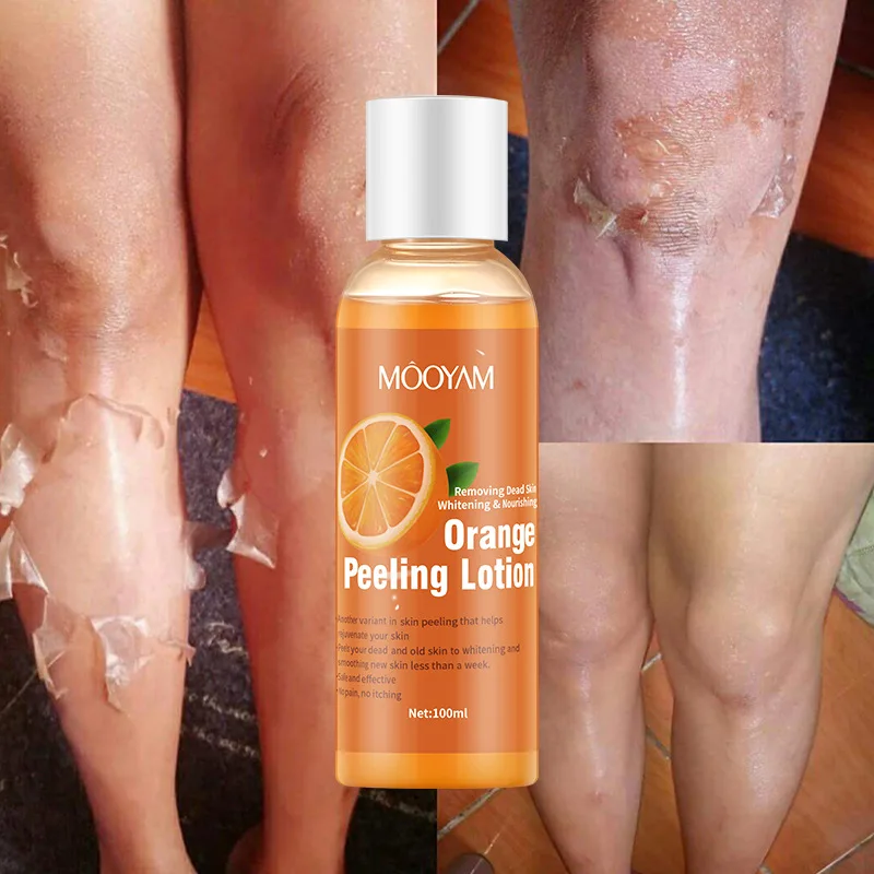 New Orange Peeling Lotion Oil Lightening Exfoliating Dark Skin Body Strong Peeling Oil Skin Exfoliator Product