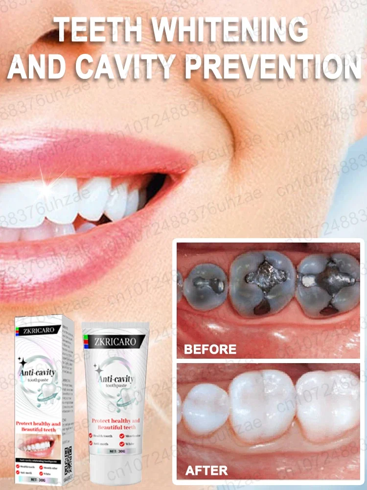 Repair cavities, Prevent tooth decay,remove plaque, toothache, whiten teeth, relieve periodontitis, freshen up bad breath