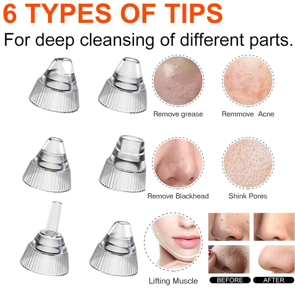 AOKO Blackhead Remover Pore Vacuum  Camera Pore Cleaner Acne Remover Electric Heating Nose Face Deep Cleansing WIFI Microscope