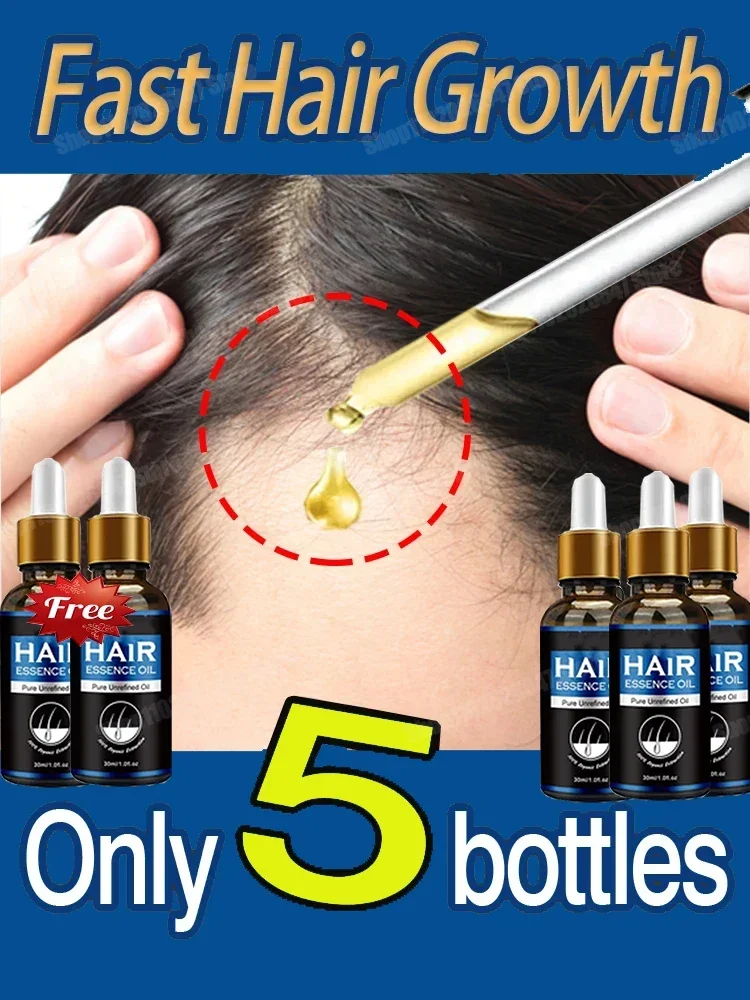 

Effective Fast Hair Growth Oil Baldness Repair Hereditary Hair Loss Postpartum HHair Seborrheic HHair Anti Loss 7 days