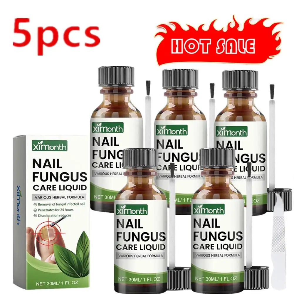 5 stücke Onycho mykose Hand Fuß entfernung Reparatur Pflege Nagel pilz Paronychie 50g Behandlung Pilz Anti-Infektion Serum Zehen