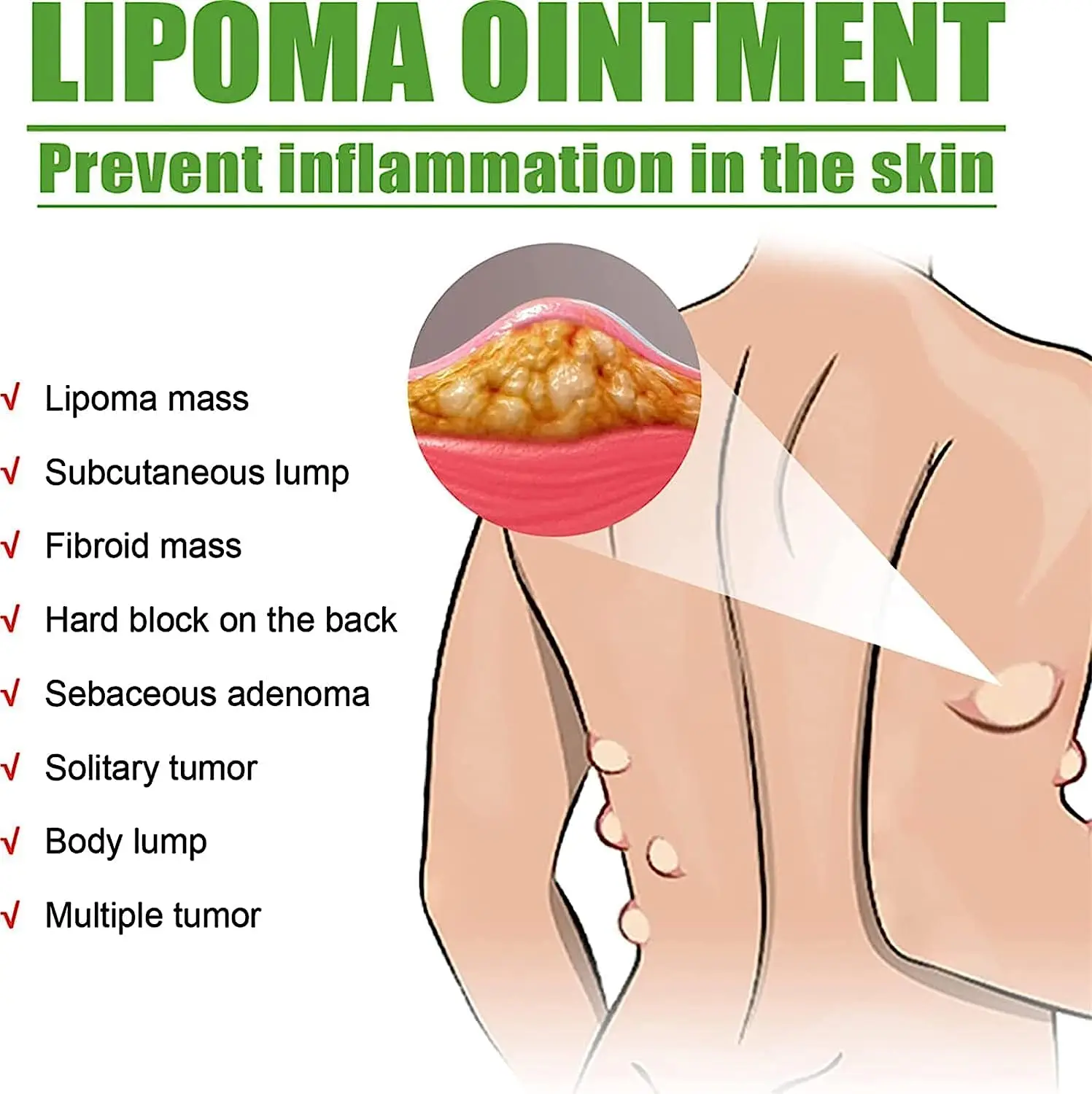 Lipoma salep menenangkan, Lumpfree, krim Anti bengkak kulit