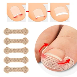 Ingrown Paronychia Toenail Corrector Strips Anti Fungal Nail Correction Stickers Anti Infection Nail Treatment Patch