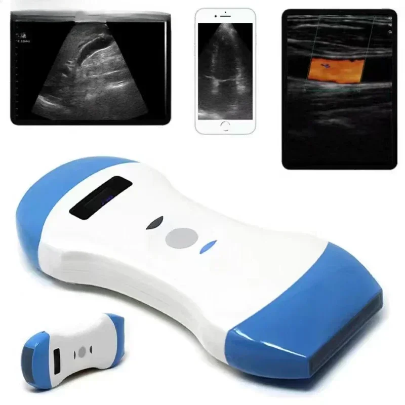 YYHC Wireless Ultrasound Probe scanner portable Bluetooth machine WIFI ultrasound scanner Machine support iOS Android Windows