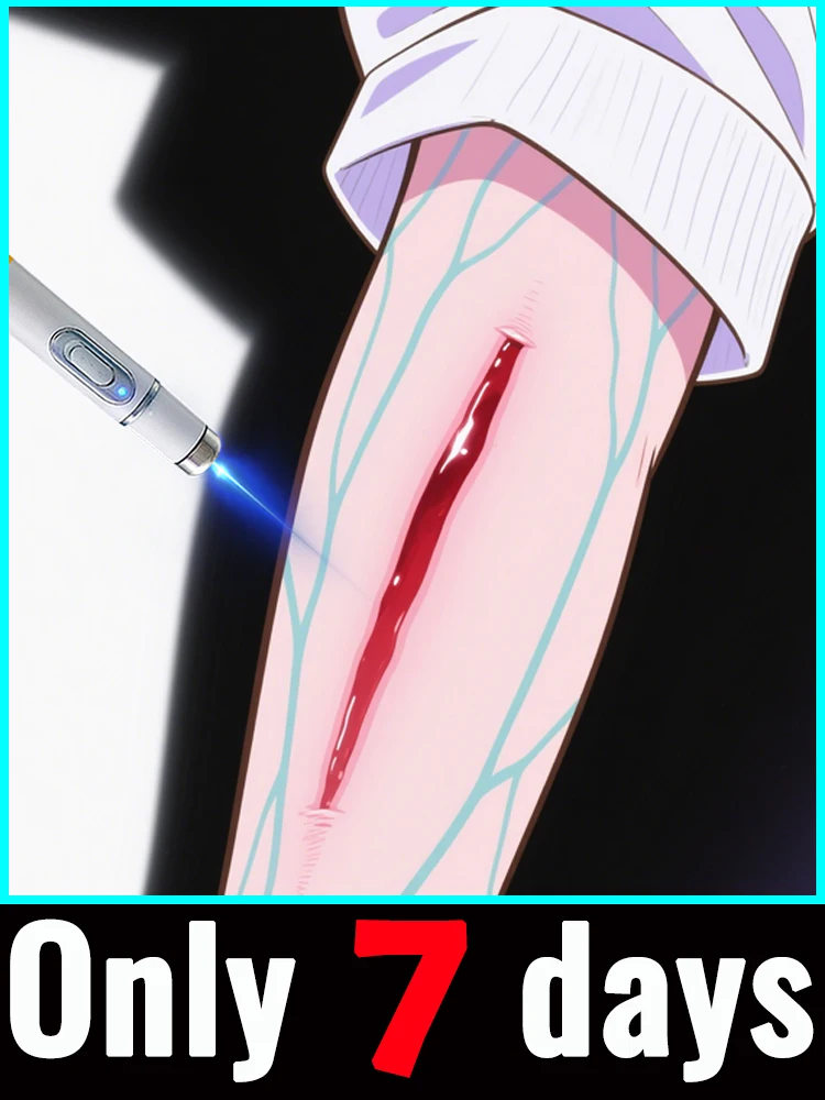 

Модернизированный шрам 2-го поколения ремонт корня шрама uickly