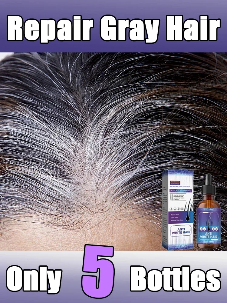 

Gray White Hair Serum White To Black Repair Natural Color Anti-gray Hair Care 5