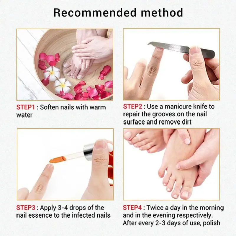 15 مللي LANBENA علاج الأظافر الفطرية قدم الرعاية جوهر إصلاح صحي الداحس فطار العدوى مصل أداة إزالة F F0Q6