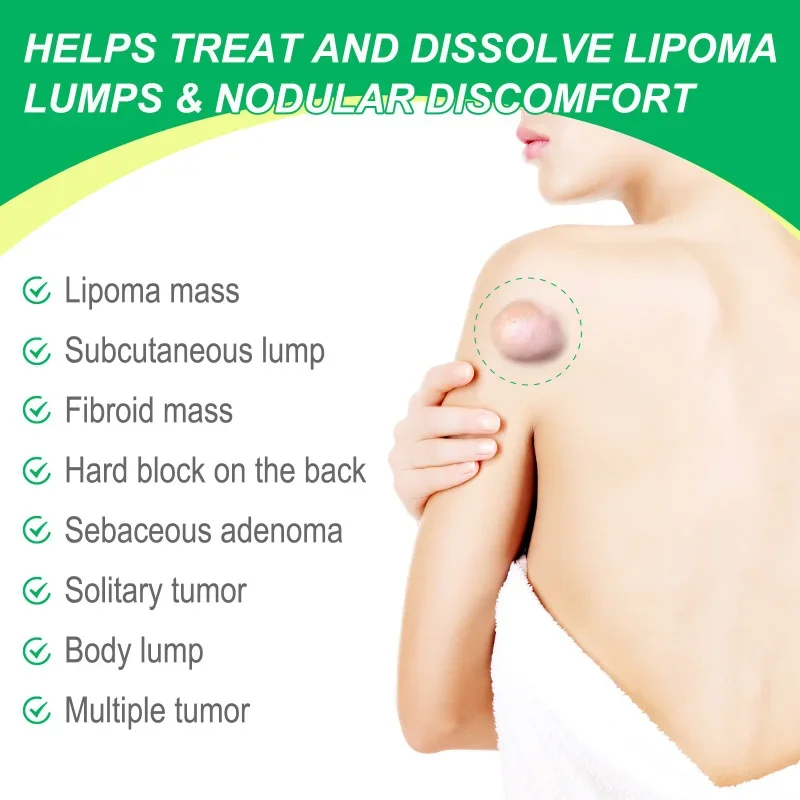 Lipoma Treatment Herbal Plaster Pain Relief Ointment Multiple Anti-Tumor Peeling Fat Mass Remover Cream Health Care Products