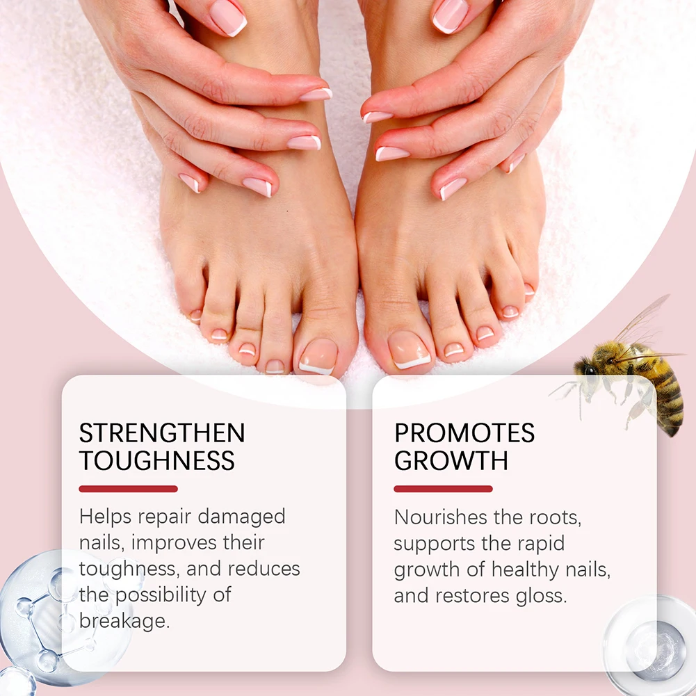 Nagellösung für Nägel mit verfärbten Schäden stellen die Verfärbungsdicke wieder her. Pflege in Salonqualität