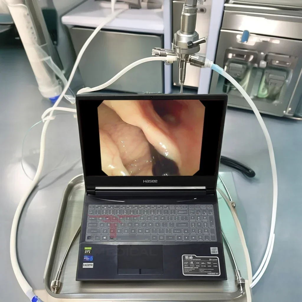 MT MEDICAL Pet Surgery  Vet Laryngoscope Animal Disposable Video Laryngoscope  Price