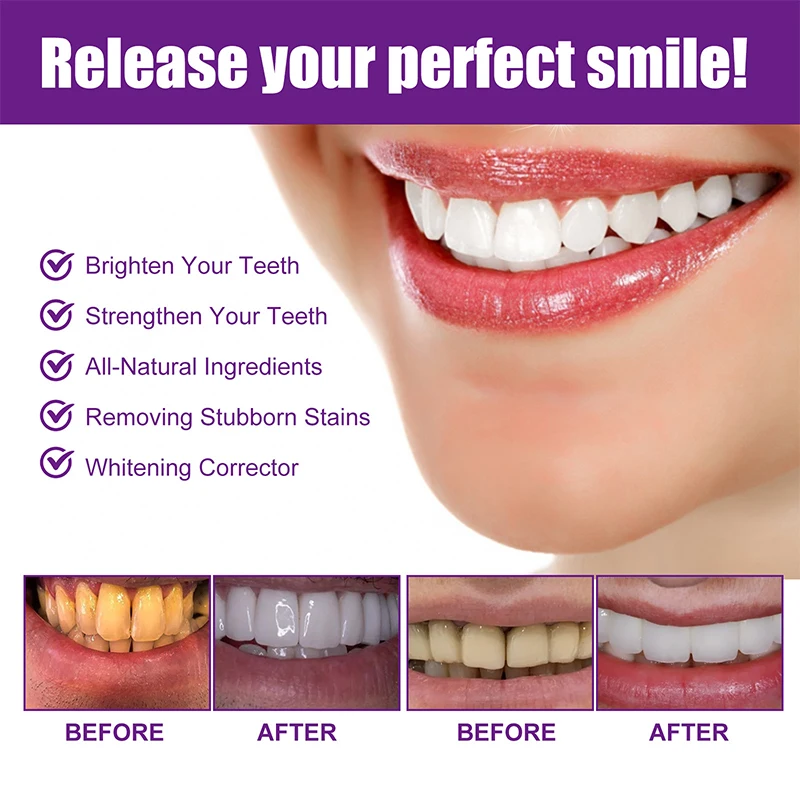 30ml Purple Whitening Toothpaste Removes Stains Reduces Yellowing Care Teeth Gums Fresh Breath Brightens Teeth