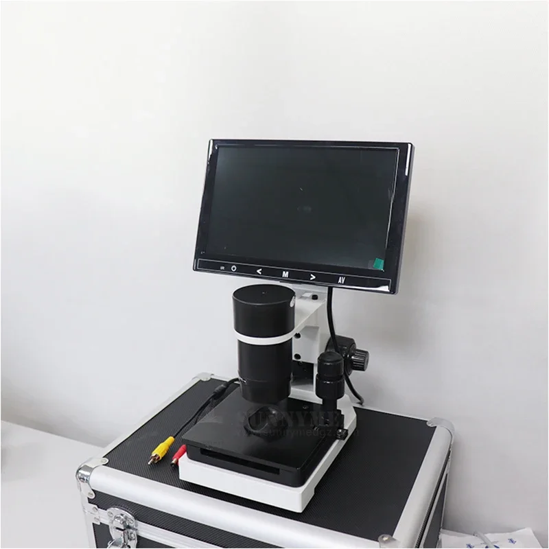 SY-B198 Clinic LCD Screen Microcirculation Microscope Capillary Microscope