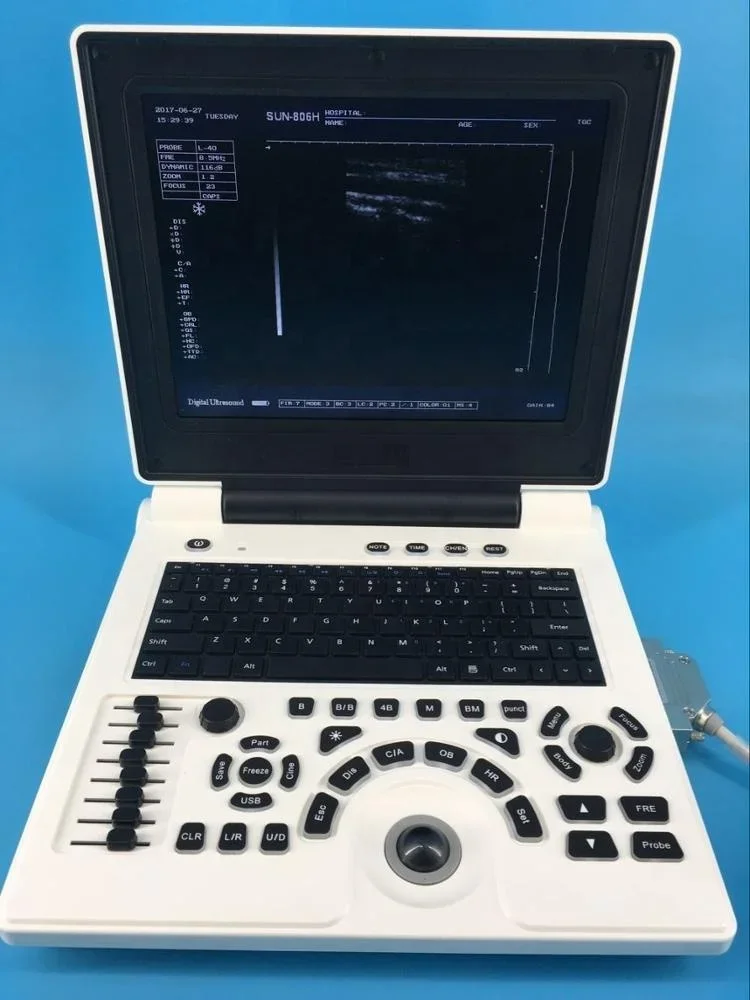 sonosite m turbo ultrasound machine with 2 Probe Connectors