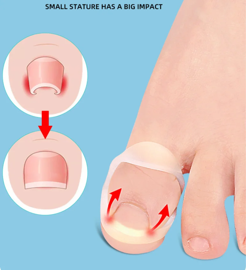 3Pcs Silicone Ingrown Toenail Correction Invisible Ingrown Toe Nail Treatment Elastic Straightening Clip Brace Pedicure Reusable