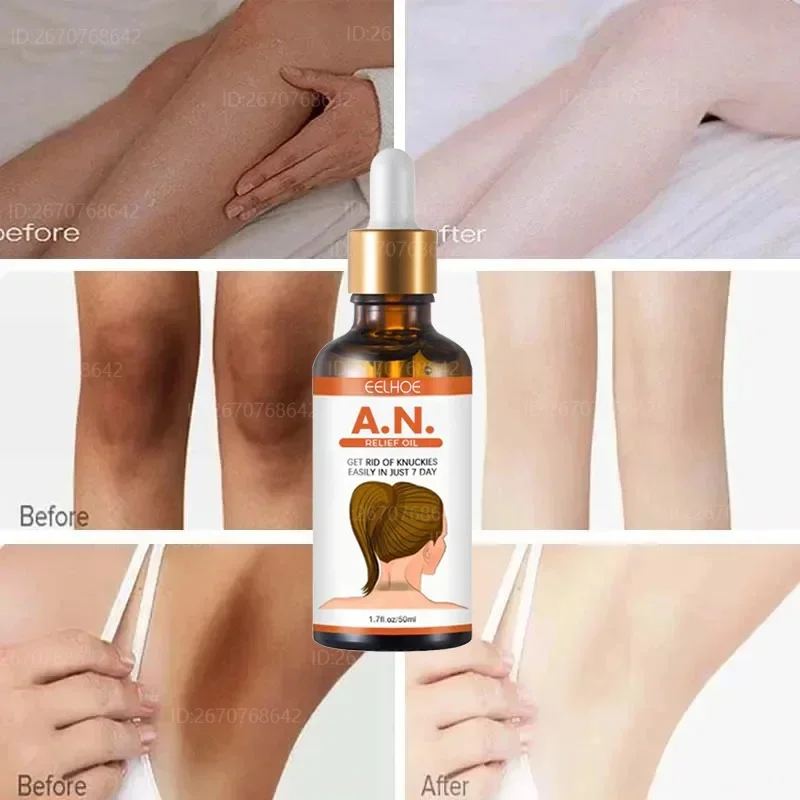 Elbow Knee Brighten Serum Hand Knuckle Powerful Brightening Essence Dark Knuckles Remove Stains Serum Black Skin Lightening Care