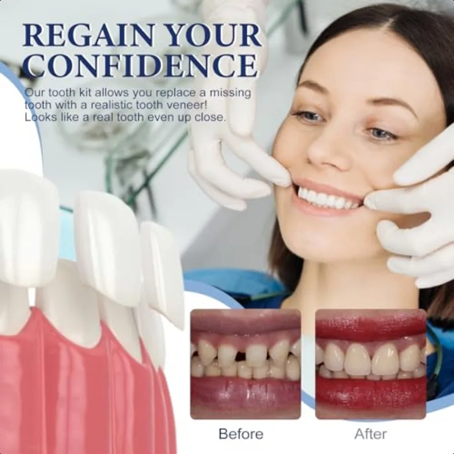 ชุดซ่อมฟันชั่วคราว วัสดุอุดฟันสีธรรมชาติ สำหรับฟันที่ขาดหายไปหรือแตกหัก ชุดดูแลฟันด้วยตัวเอง รุ่น SolutionMM5