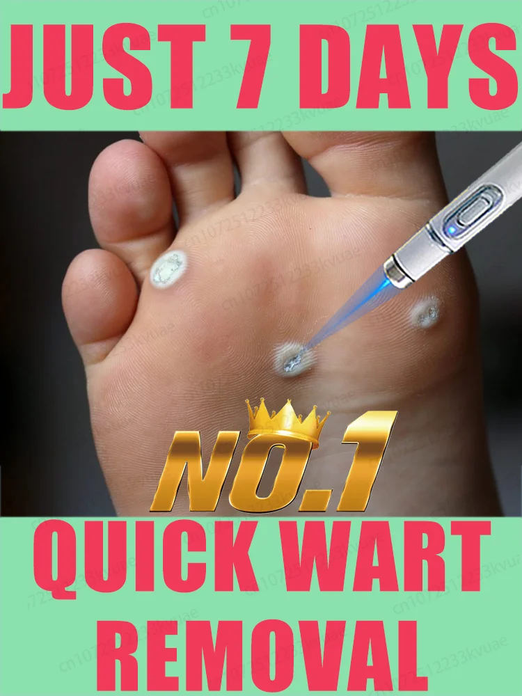 

ᴸᵃˢᵉʳ ᵖᵉⁿ ᵃᶜᶜᵘʳᵃᵗᵉˡʸ ʳᵉᵐᵒᵛᵉˢ warts without scarring or recurrence