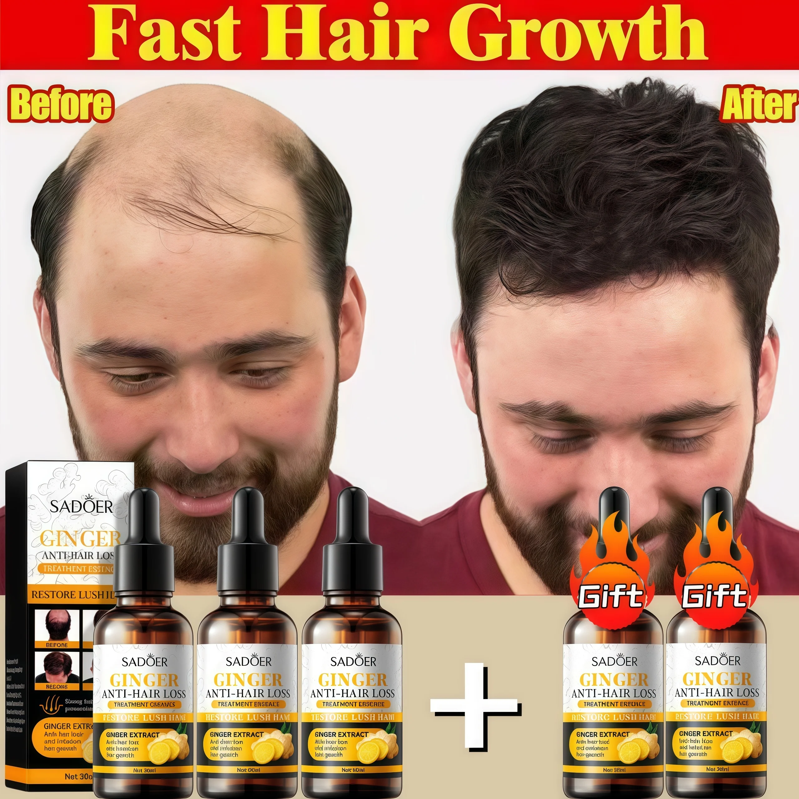 

Ginger Hair Growth Serum Anti Hair Loss Fast Growth Strengthens Hair Light Weight Non Greasy Relief Hair Care For Women Men