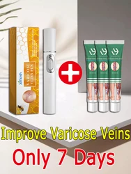 Varicosse Cream Laser