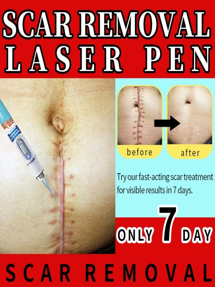

ᶠⁱʳˢᵗ ᵖˡᵃᶜᵉ ⁱⁿ ˢᶜᵃʳ ʳᵉᵖᵃⁱʳ ᵃⁿᵈ ʳᵉᵐᵒᵛᵃˡ,Easy to remove any scars, scar killer