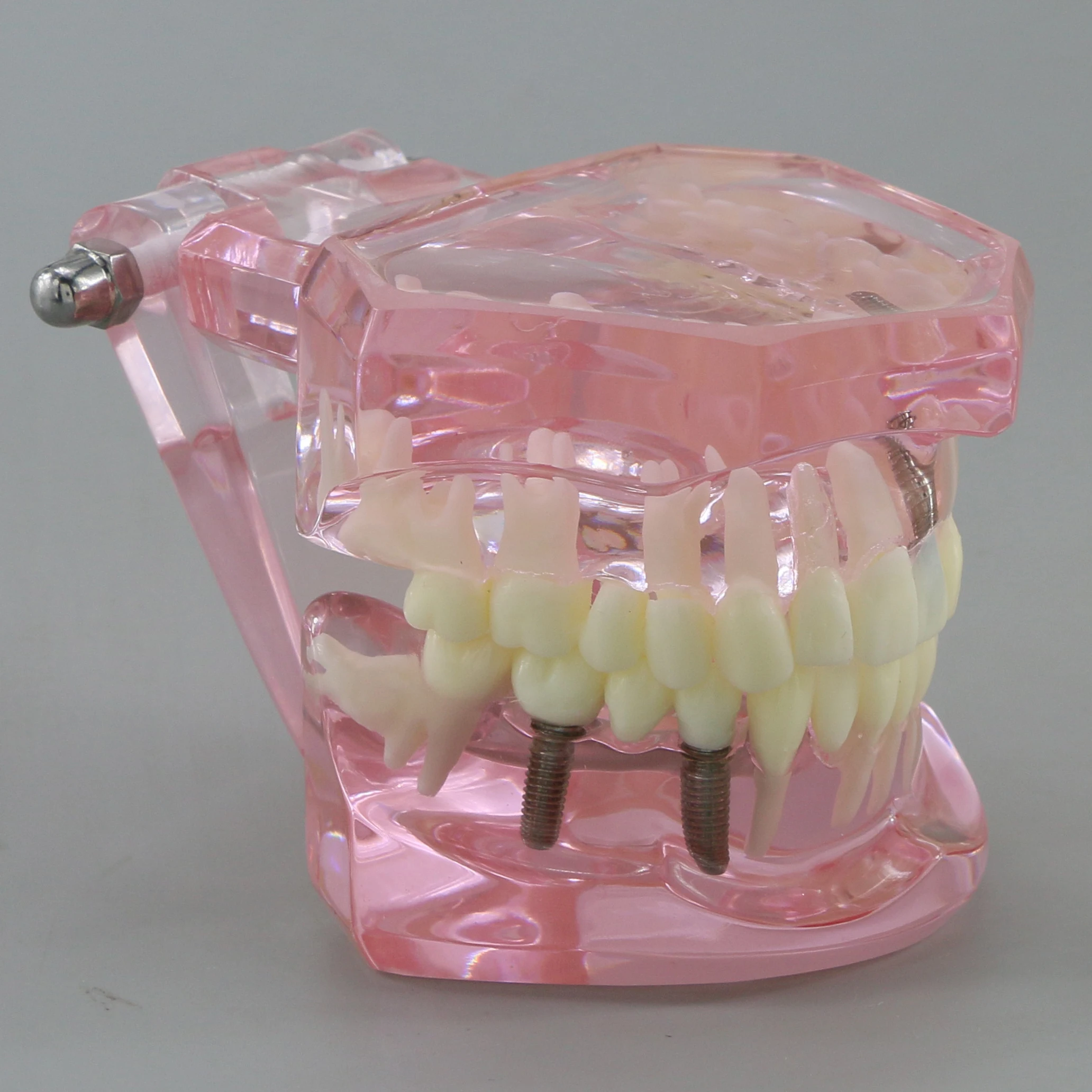 Dental Teeth Model Teaching Model Implant Disease Teeth Repair Restoration Bridge for Dentist Teaching Studying Demo M2001 Pink.