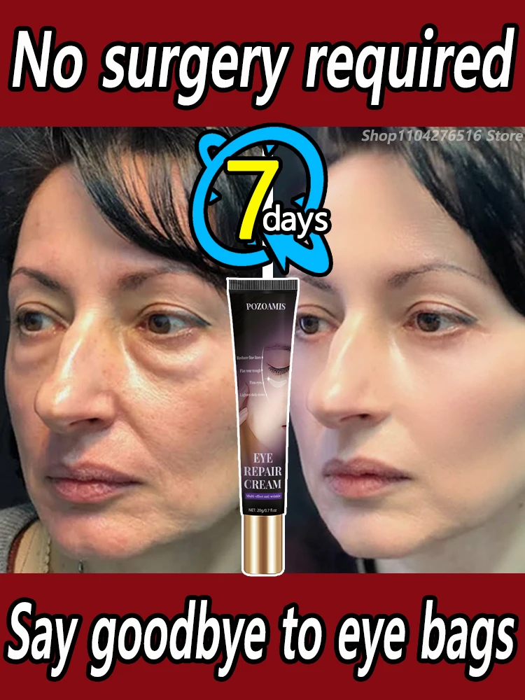 

Say goodbye to big eye bags and restore the firmness of your eyes