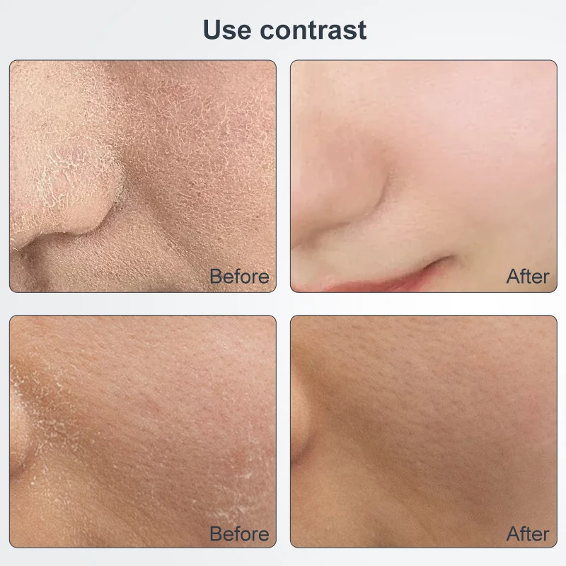 Lesen Beauty Draadloze diamantmicrokristalhuidpolijstmachine voor het verwijderen van mee-eters, diepe reiniging, anti-aging rimpelverzorgingstool