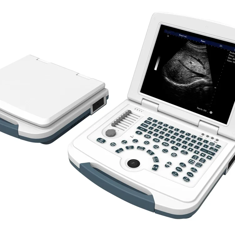 Stock !!!china Portable Dawei Laptop Ultrasound Machine For pre gnancy MSLPU09 With Multiply Language