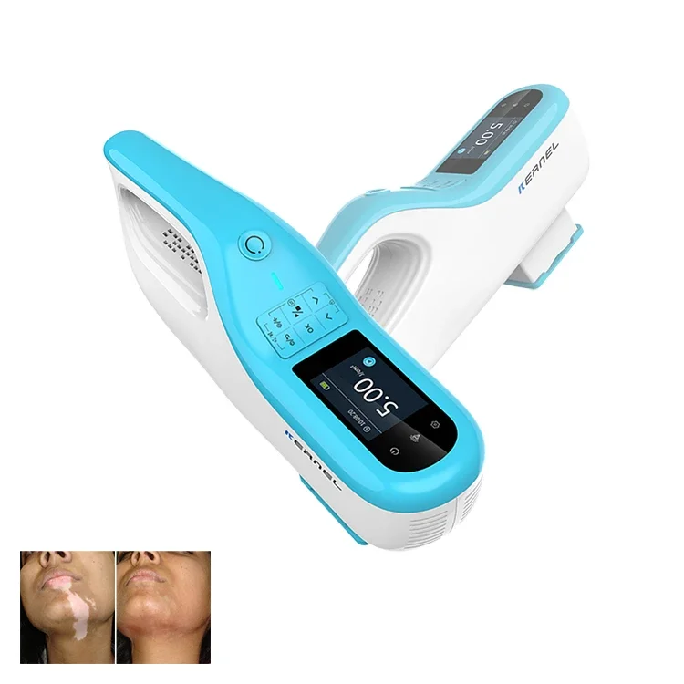 Excimer  Vitiligo 308nm KN-5000E Handheld UV Phototherapy For Psoriasis