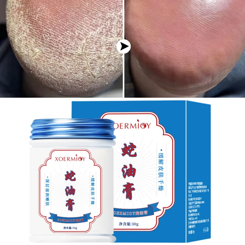 

Herbal Anti Crack Foot Cream Heel Cracking Repair Products Exfoliation Dead Skin Removal Softening Moisturize Smooth Skin Care