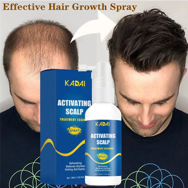 Poderoso Crescimento Do Cabelo Soro Spray Anti Perda De Cabelo Essência Óleo De Crescimento Rápido Tratamento Raízes Do Cabelo Regrowth Cabelo Para Homens Mulheres