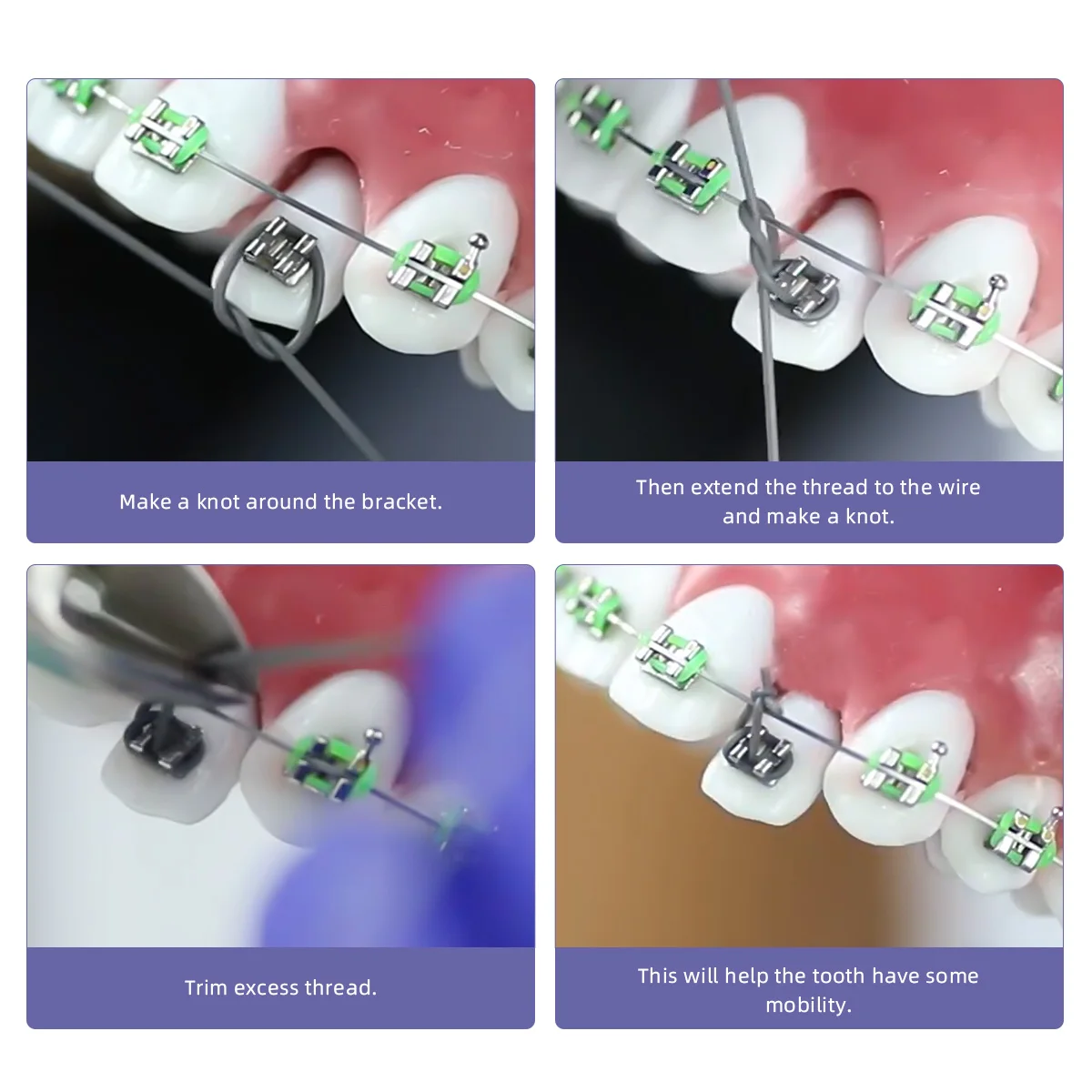 25 Fuß/Rolle AZDENT Dental Kieferorthopädischer Elastikfaden Solider Traktions-Ligaturdraht Power Tube Ortho-Drahteröhrchen Größe 0,020/0,025/0,030 – Detail 3