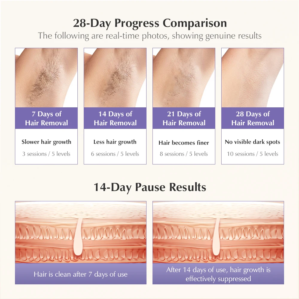 T14 Laser Hair Removal IPL Laser Epilator ICE Cold 500000 Flashes 3IN1Automat Home use For Women Men Body Depilador a laser