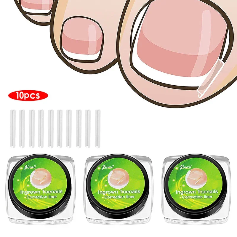 10pcs Ingrown Toenail Correction Tool Ingrown Toe Nail Treatment Elastic Patch Sticker Straightening Clip Brace Pedicure Tool