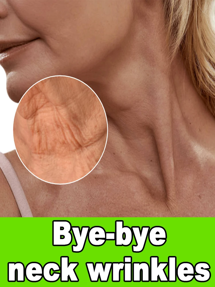 le-rughe-sul-collo-scompaiono-collo-bellissimo